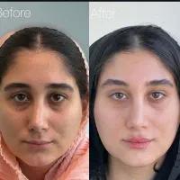 ژل لب روسی مادلینگ عربی زاویه سازی بوتاکس بادی|خدمات آرایشگری و زیبایی|تهران, سعادت‌آباد|دیوار