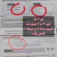 خطر سلامتی با کبد چرب|خدمات آرایشگری و زیبایی|تاکستان, |دیوار