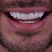 دندانپزشکی تخصصی با شرایط اقساط