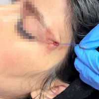 تزریق ژل و بوتاکس و مادلینگ عربی|خدمات آرایشگری و زیبایی|کرمانشاه, |دیوار