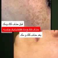 درمان مشکلات پوستی