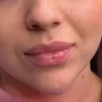 خدمات زیبایی ژل و بوتاکس|خدمات آرایشگری و زیبایی|اردبیل, |دیوار