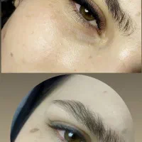 کاشت مژه  و لیفت مژه وابرو