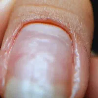 مدل کاشت ناخن