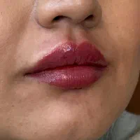 دکتر اکرم آقابیگی پوست مو زیبایی