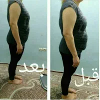 لاغری وکاهش سایز تضمینی بدون بازگشت باکرایولیپولیز