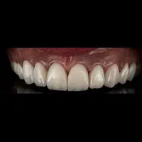 دستیار دندانپزشک|استخدام درمانی، زیبایی، بهداشتی|تهران, شهرک ولیعصر جنوبی|دیوار