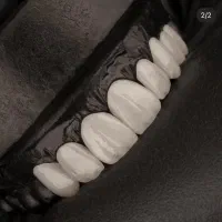 لابراتوار دندانسازی