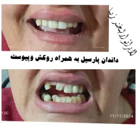 لابراتوار لبخند زیبا مبلغ ۱۵ میلیون و چک صیادی|خدمات آرایشگری و زیبایی|آباده, |دیوار