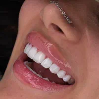 کامپوزیت از فکی 7تومن