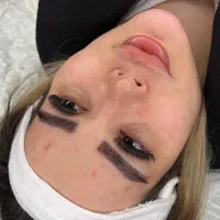 میکروکاشت ابرو و کاشت مو کاشت ریش با کیفیت vip