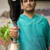 ساخت تخصصی پروتز پا (پای مصنوعی)