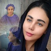 جراحی بینی در تهران/شرایط ویژه برای مراجعین دهدشت