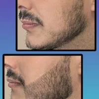 10 روز|آرایشی، بهداشتی، درمانی|کرج, حصار|دیوار