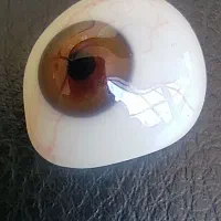 ‌پروتز چشم متحرک