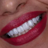 دندان کامپوزیت دندانپزشکی باهوش مصنوعی|خدمات آرایشگری و زیبایی|مشهد, دانشجو|دیوار