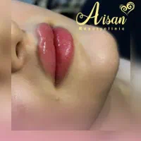 تزریق ژل و بوتاکس در کلینیک زیبایی|خدمات آرایشگری و زیبایی|کرمانشاه, |دیوار