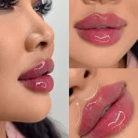 مدل تزریق ژل،فیلر،بوتاکس،لیفت بانخ،جوانساز|خدمات آرایشگری و زیبایی|کرج, مهرویلا شمالی|دیوار