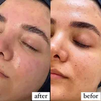 جشنواره فشیال تخصصی با ۵۰٪ تخفیف فقط برای ۵ نفر
