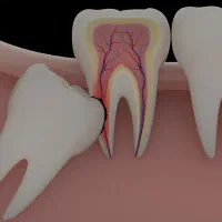 استخدام دستیار دندانپزشکی