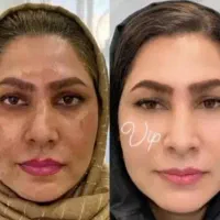 کرم روشن کننده با کمترین قیمت اصلی تضمینی