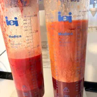 جشنواره لیپو ۲۹تومن ،تزریق چربی،ابدو،مامو،بازو