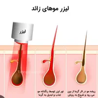 لیزر الکساندرایت تینانیوم