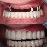 نیاز به دستیار دنداپزشکی