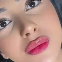 مدل جهت بوتاکس