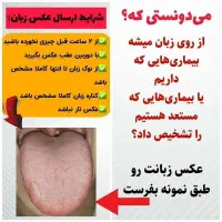 تشخیص بیماری ازروی عکس زبان