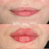 استخدام کلینیک جراحی( پرستارمشاور)|استخدام درمانی، زیبایی، بهداشتی|تهران, قیطریه|دیوار