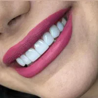 کامپوزیت کن بدون پیش پرداخت|خدمات آرایشگری و زیبایی|کرج, ساماندهی|دیوار
