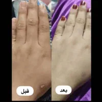 پوستت روزیباترکن|خدمات آرایشگری و زیبایی|مهران (هرمزگان), |دیوار