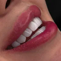 کامپوزیت دندان / لمینت و ایمپلنت / دندانپزشکی|خدمات آرایشگری و زیبایی|تهران, هفت حوض|دیوار