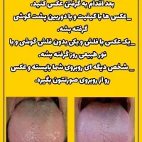 درمان قطعی وبدون بازگشت پوستی|آرایشی، بهداشتی، درمانی|سیرجان, |دیوار