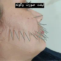 چکاپ کلی خدمات زیبایی طب سنتی حجامت زالو بادکش فصد|خدمات آرایشگری و زیبایی|اصفهان, برازنده|دیوار