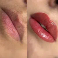زیباییتو دائمی کن