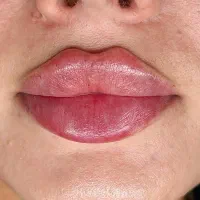 مجهزترین کلینیک تخصصی پوست و مو و زیبایی رودهن