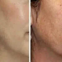 کرم معجزه شب اصل رفع لک وجوش وسفیدشدن پوست|آرایشی، بهداشتی، درمانی|قم, چهار مردان|دیوار