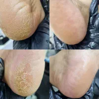 ۱۰٪تخفیف روخدمات ناخن وپا توفاز۸پردیس|خدمات آرایشگری و زیبایی|پردیس, فاز ۸|دیوار