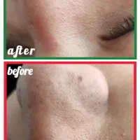 دوره کرمپودر زدن تموم شد|خدمات آرایشگری و زیبایی|زنجان, |دیوار