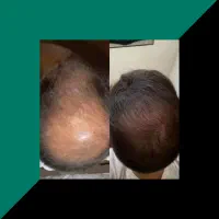 این اقدام اخریشه