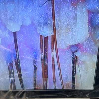 درمان شوره  ریزش مو چرپی وخشکی مو