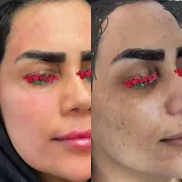 سفید شو و جوان شو پرداخت درب منزل