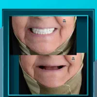 مرکز تخصصی ایمپلنت دندانپزشکی شیراز / تعرفه دولتی|خدمات زیبایی و سلامت|شیراز, ملاصدرا|دیوار