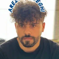 کاشت مو و ابرو حرفه ای