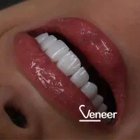 دندانیزشکی کامپوریت لمینت اینیلنت|خدمات آرایشگری و زیبایی|تهران, قیطریه|دیوار