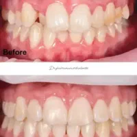 ارتودنسی|خدمات آرایشگری و زیبایی|شیراز, کیان آباد|دیوار