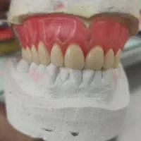 ( دندان سازی لبخند )|خدمات آرایشگری و زیبایی|زنجان, |دیوار