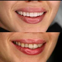 دندانپزشکی قسطی در مطب لنگرود